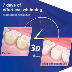 Teeth Whitening Strips – Bright Smile at Home!