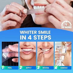 Teeth Whitening Strips – Bright Smile at Home!